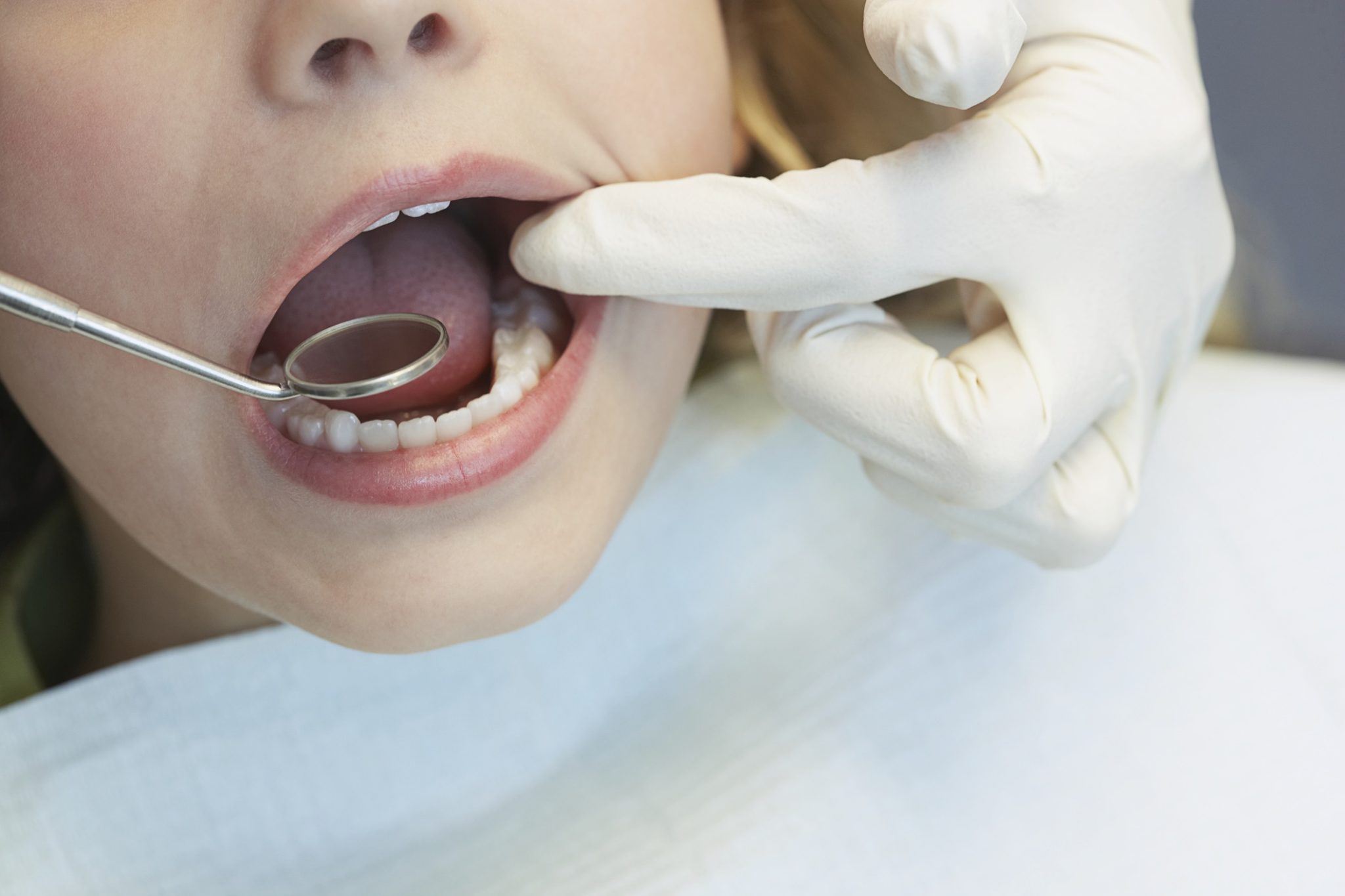 manage dental phobia